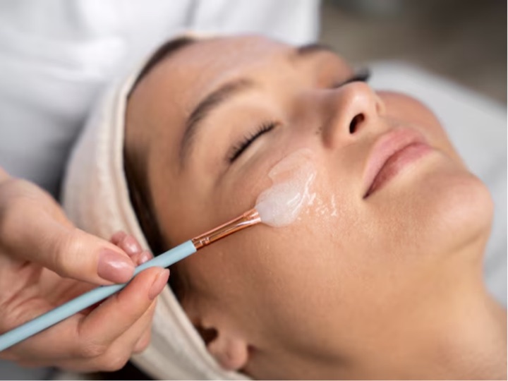 Medical-grade chemical peel skin treatment